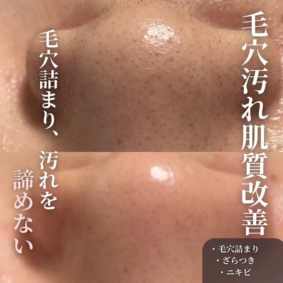 【毛穴ケア　フェイシャル仙台】