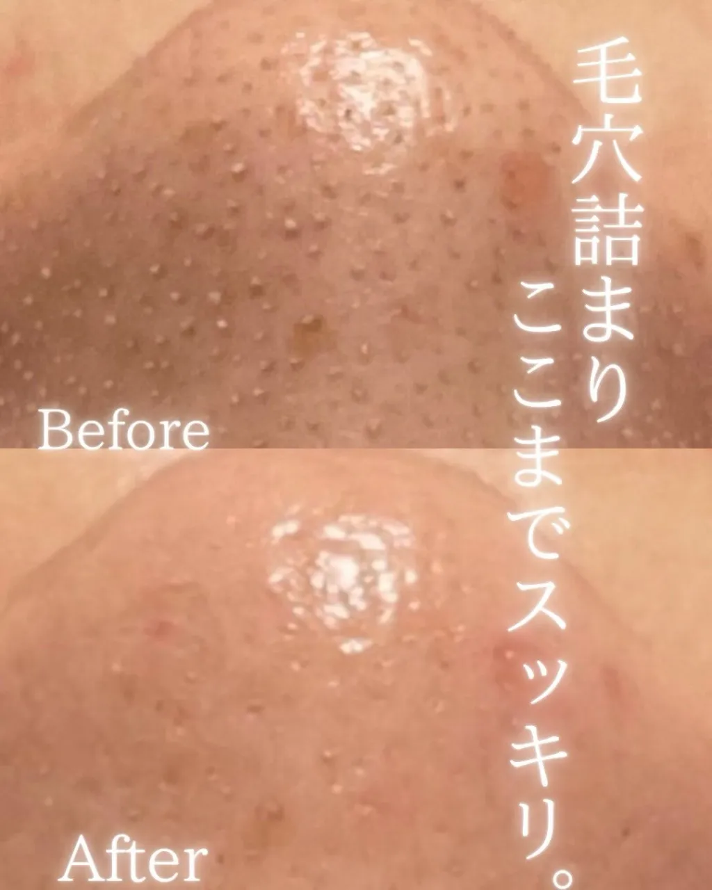 毛穴って、ちゃんとケアすれば変わっていく✨