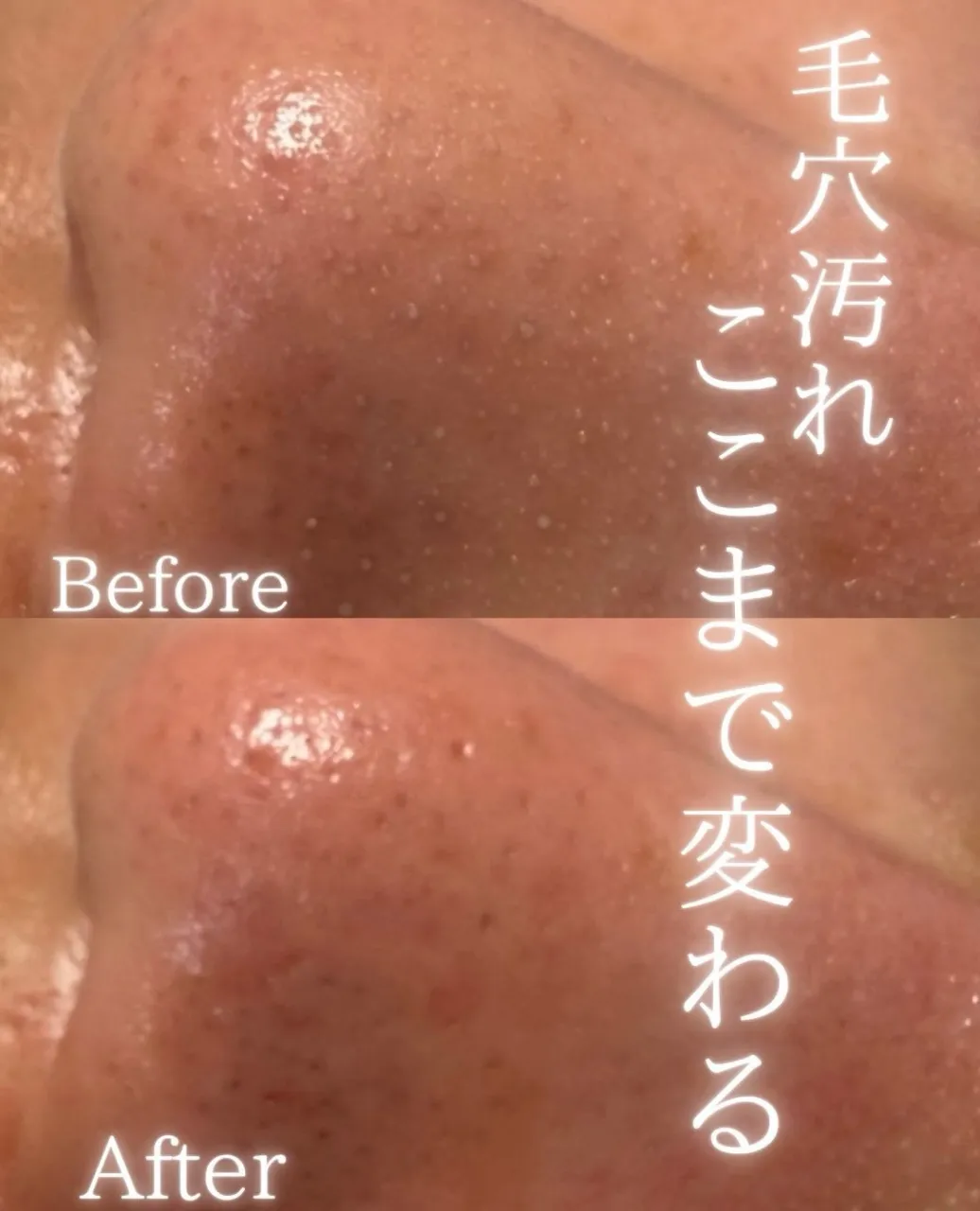 毛穴ケア、まだ2回目。