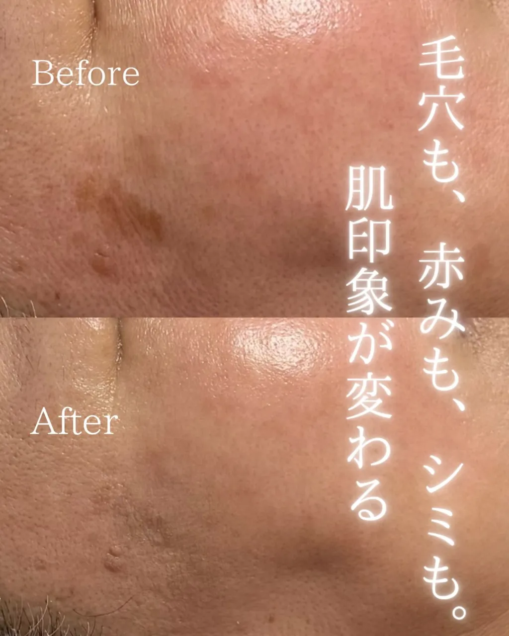 60代からでも、お肌は変わる。