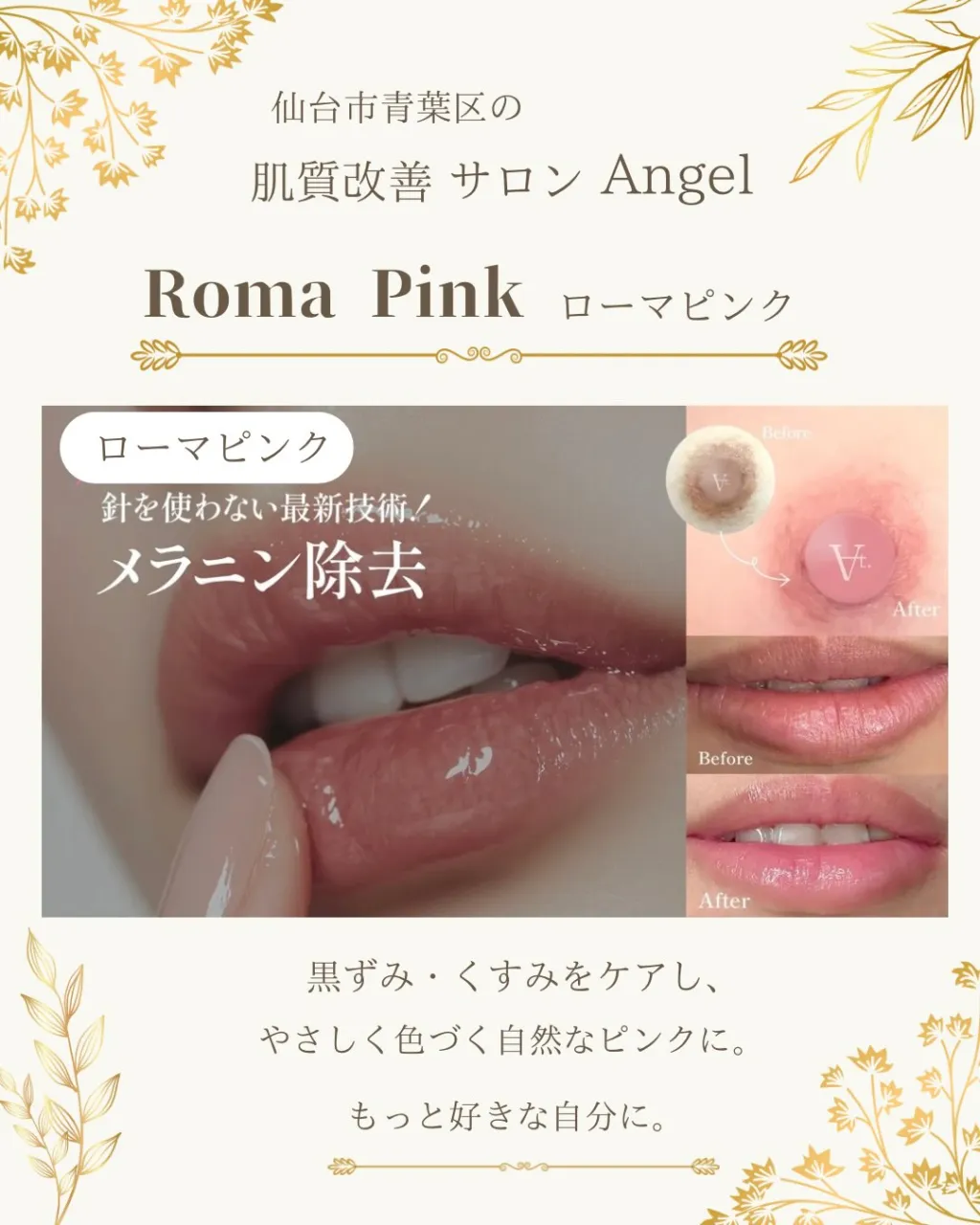 Treatment Menu｜肌質改善サロン Angel
