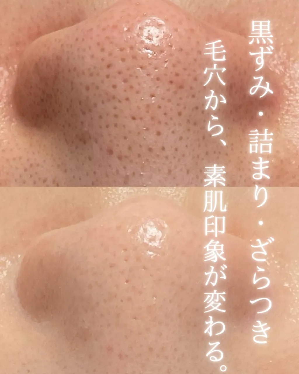 30代会社員のお客様｜毛穴・赤み・ニキビケア
