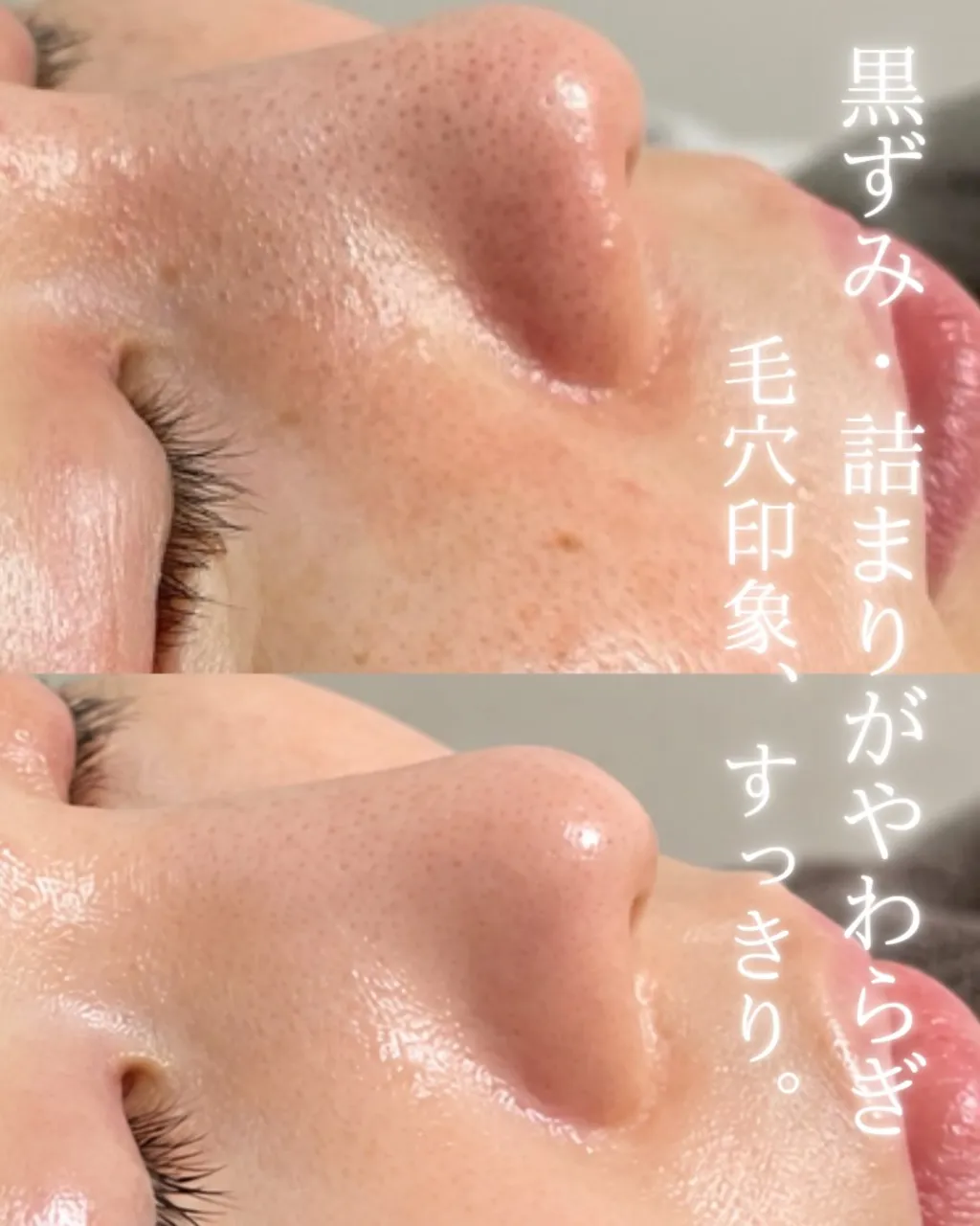1年かけて、少しずつ。